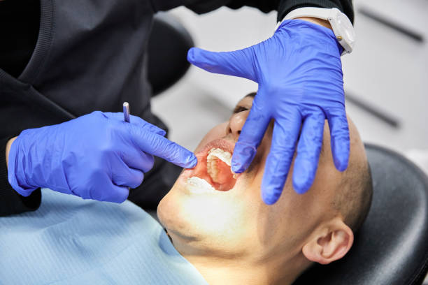 Best Dentist for Tooth Abscess  in St Peter, MN