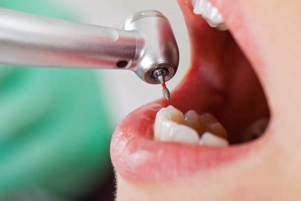 Best Tooth Pain Emergency Relief  in St Peter, MN